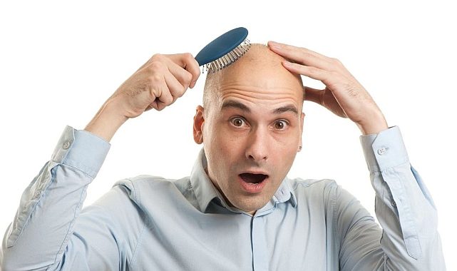 Erkekler Neden Kel Kalır?