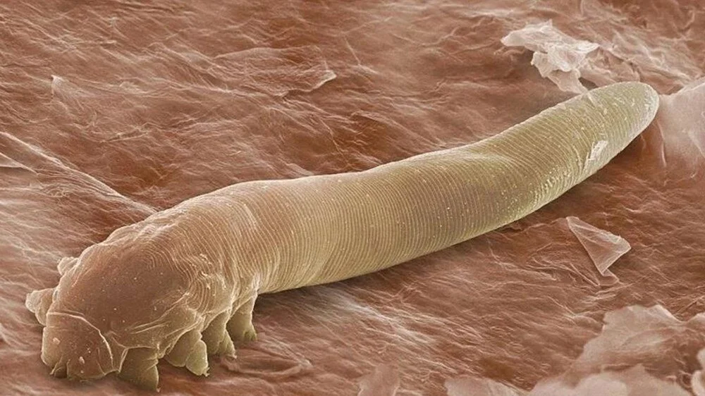 Yüzümüzde yaşayan mikroskobik misafir: Demodex akarlarıyla tanışın