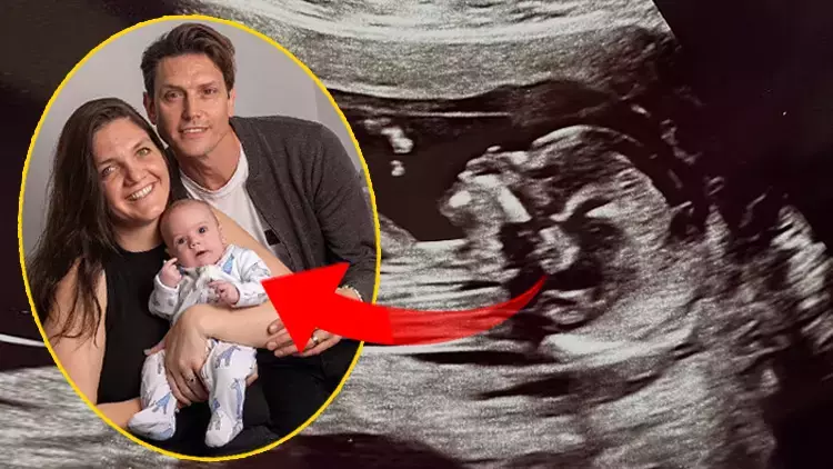 İki kez doğan mucize bebek annesini de kurtardı