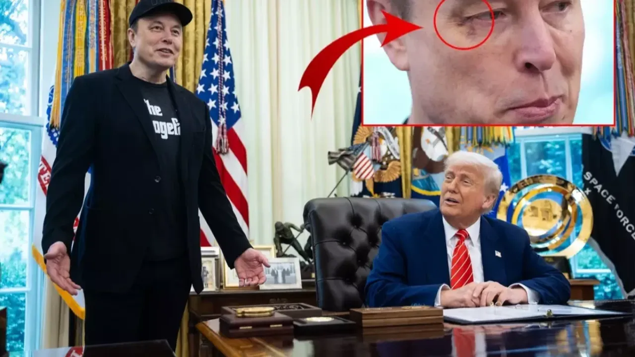 Elon Musk&#039;ın gözünü kim morarttı?