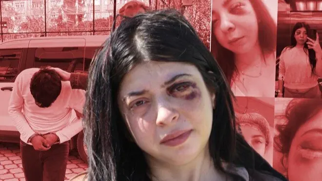 Sokak ortasında dövülmüştü! Karar açıklanır açıklanmaz Damla fenalaştı