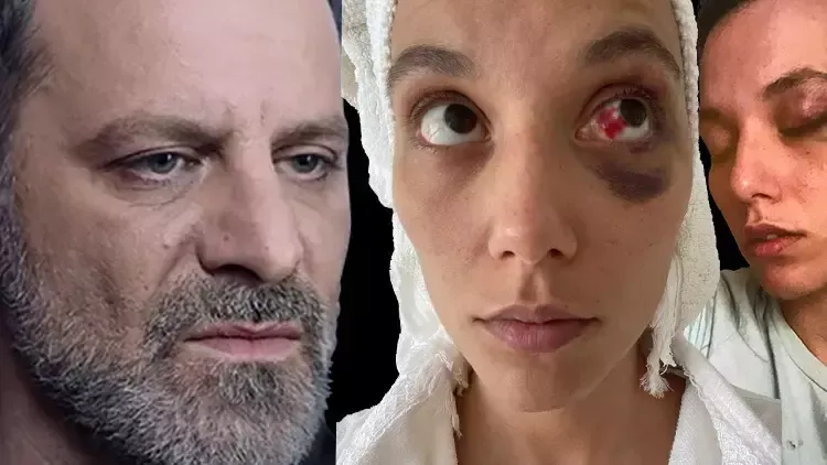 Ozan Güven’e kasten yaralama suçundan hapis cezası