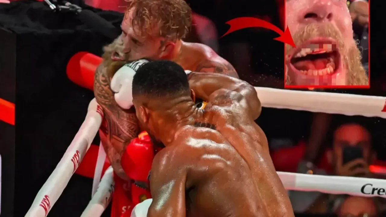Anthony Joshua maçında Jake Paul'un çenesi kırıldı